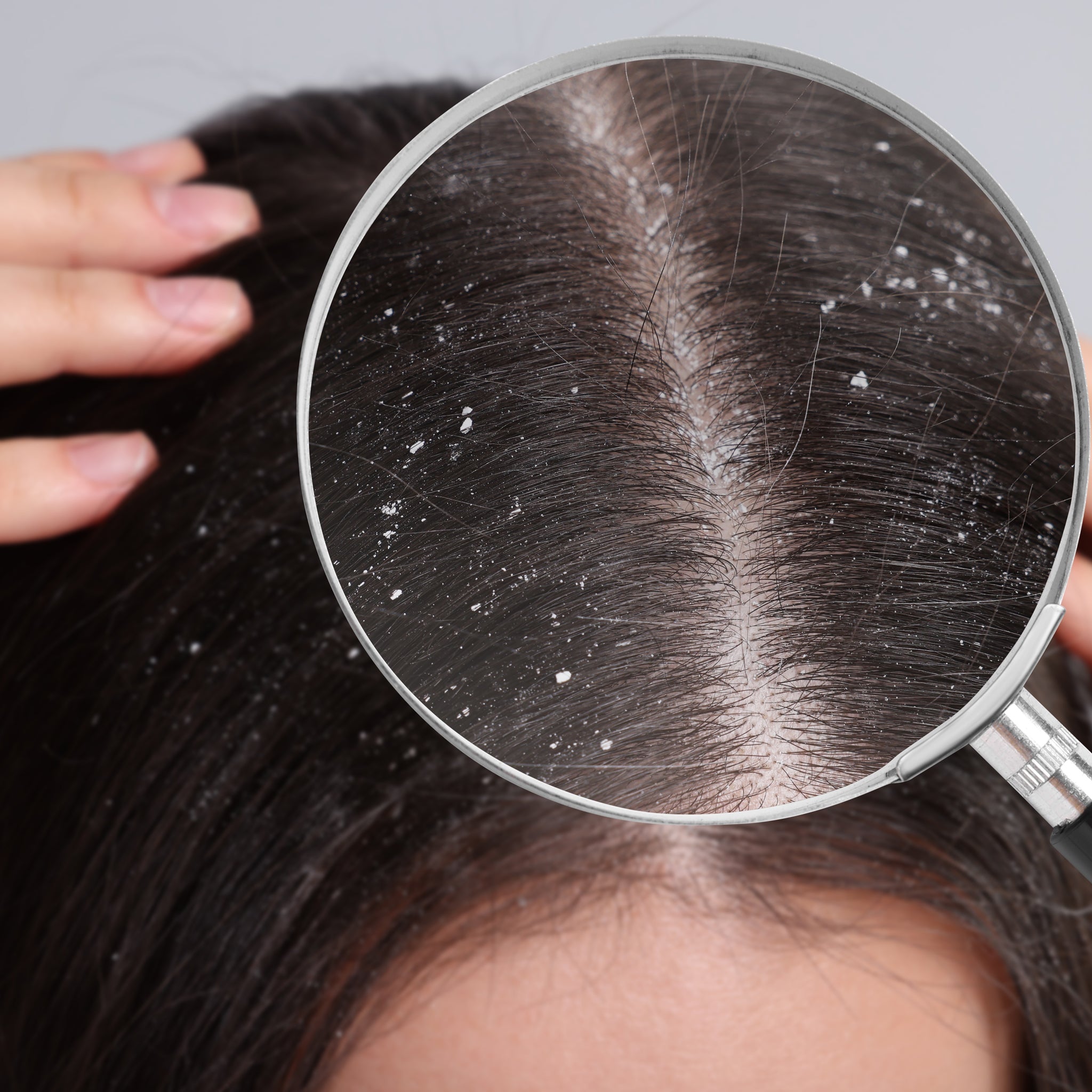 Anti-Dandruff Scalp Treatment - Wild Mint Oil, Coconut, Wax